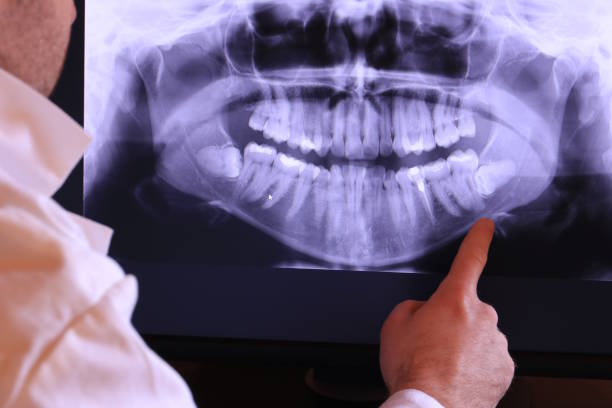 Best Knocked-Out Tooth Emergency  in Florence Graham, CA